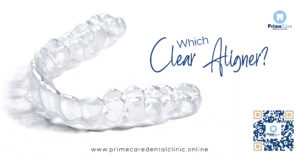 Clear Aligner