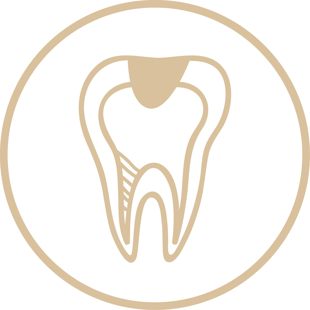 Tooth Filing