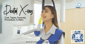 dental x-ray