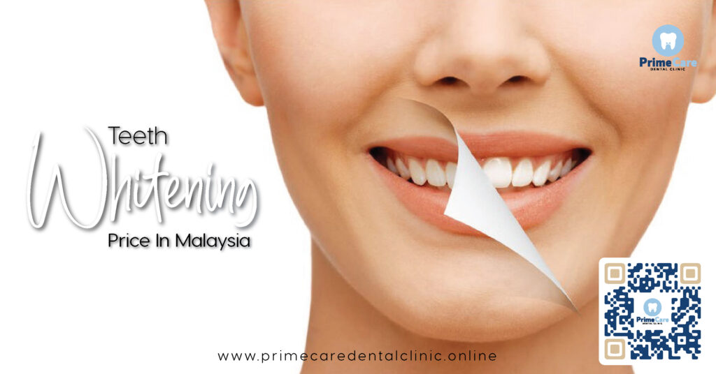 teeth whitening