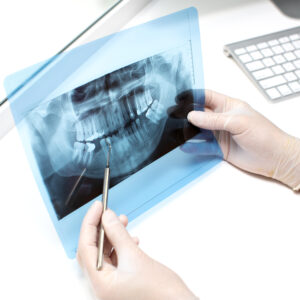 Dental X-Ray