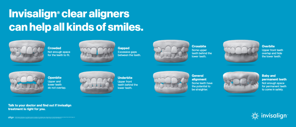 What dental conditions do Invisalign address?​